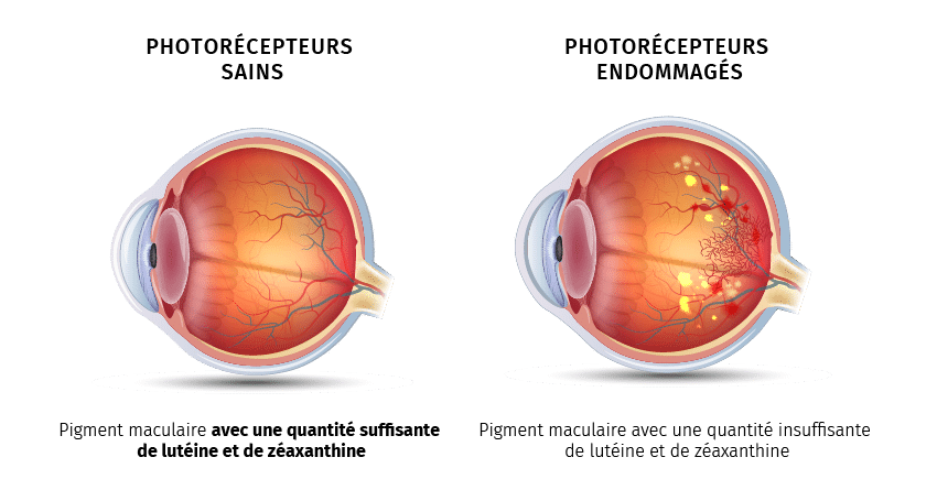 Eye PROtect 1+1 GRATUIT